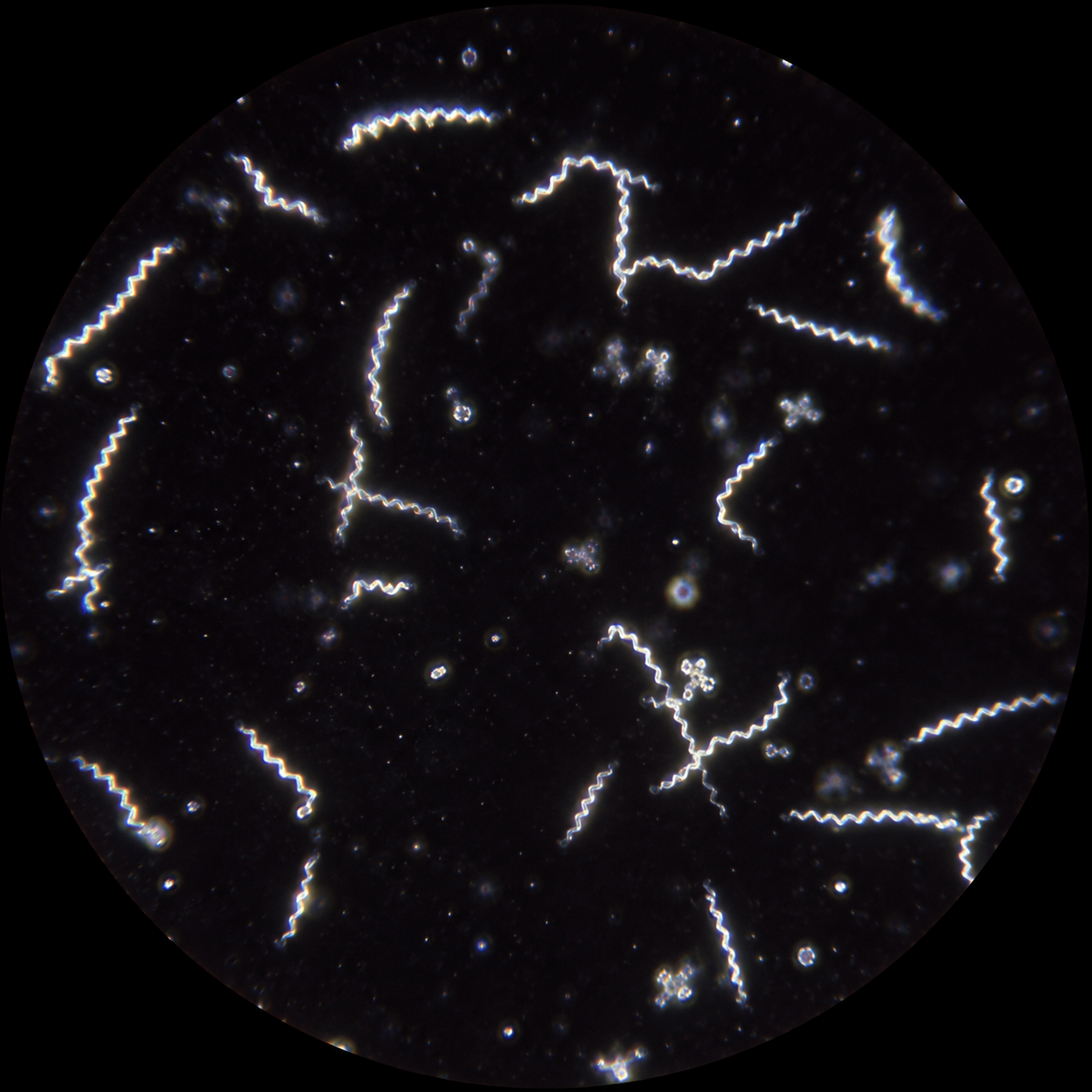 Spirochetes under magnification